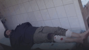 Активіст Євромайдану Максим Кицюк після побиття у Франківську отримав відповідь ОГП