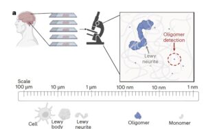 Вчені вперше побачили білкові структури, що запускають хворобу Паркінсона